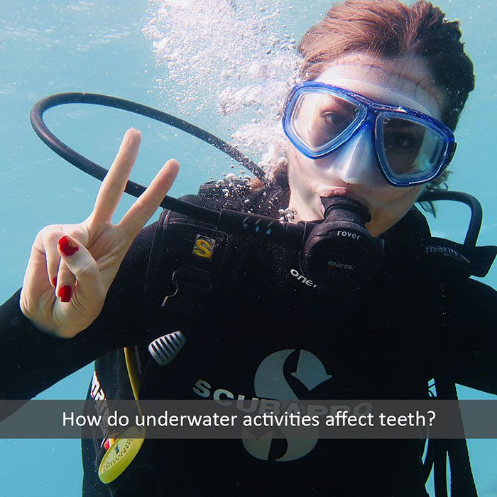 underwater teeth 2022 700 Dr. Mimi M. Cabanban Family Dentistry
