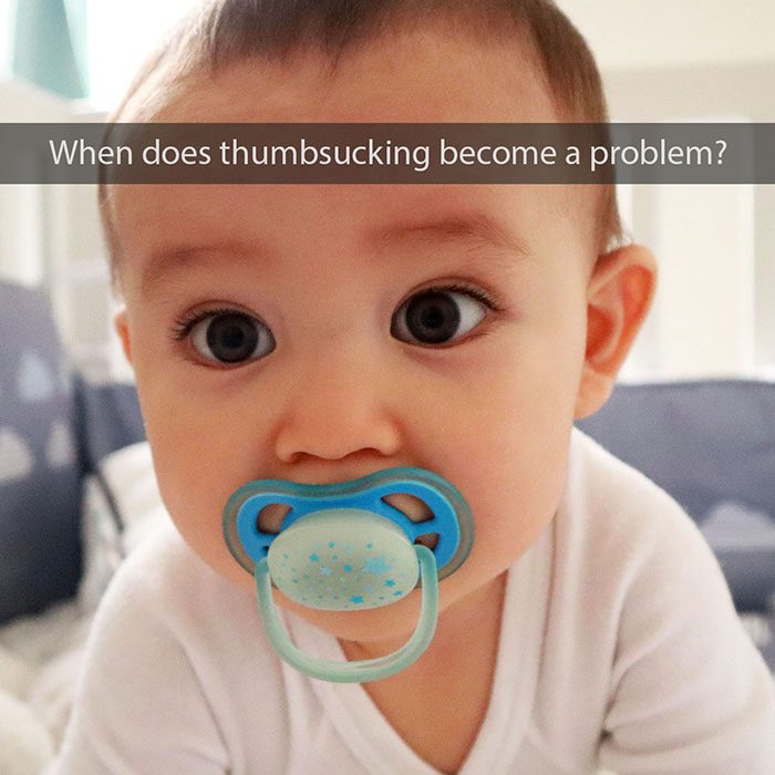 thumbsucking pacifiers 2022 700 Dr. Mimi M. Cabanban Family Dentistry