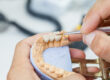 dental bridges in lakewood